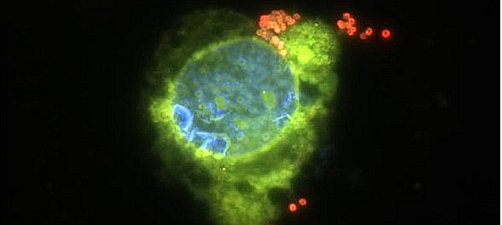 Bactéries Neisseria meningitidis