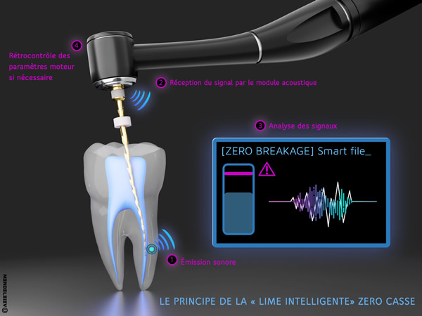 Visuel lime intelligente @Micro-Mega