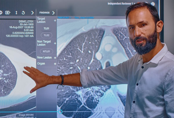 L’IA pour le diagnostic précoce des cancers ©Median Technologies